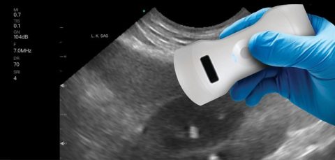 Ultrasound