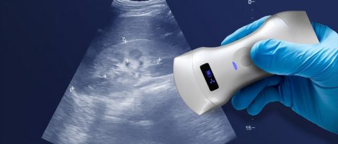 Ultra Sound Machine